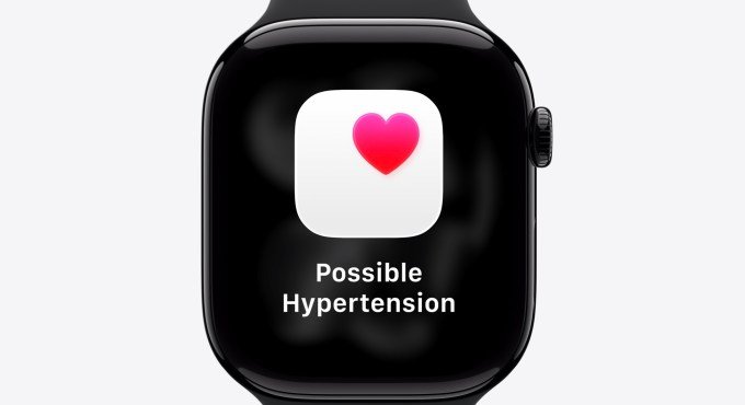 Apple Watch Series 11 features